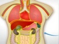 Organtransplantation 2 for at spille online